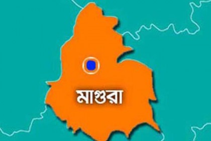মাগুরায় দুই মাথা নিয়ে শিশুর জন্ম