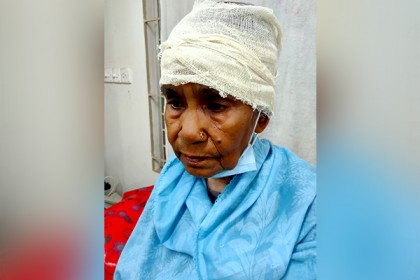 চকরিয়ায় মামলার সাক্ষী দেয়ায় বৃদ্ধা মাকে কুপিয়ে জখম