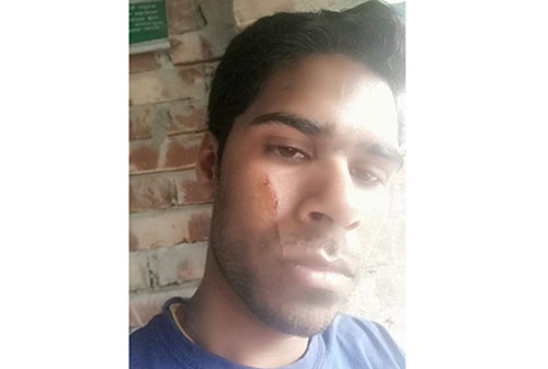 টেলিভিশনে সাক্ষাৎকার দেওয়ায় নির্যাতন