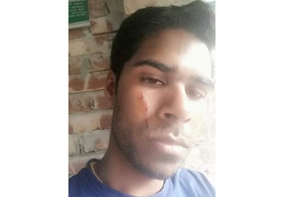 টেলিভিশনে সাক্ষাৎকার দেওয়ায় নির্যাতন