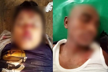 আগৈলঝাড়ায় মোটরসাইকেল দুর্ঘটনায় স্কুলছাত্র নিহত