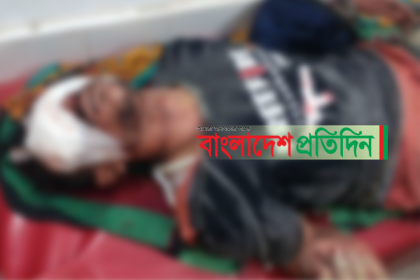 বাগেরহাটে সন্ত্রাসীর পা ভেঙে দু’চোখ নষ্ট করে দিয়েছে অতিষ্ঠ এলাকাবাসী