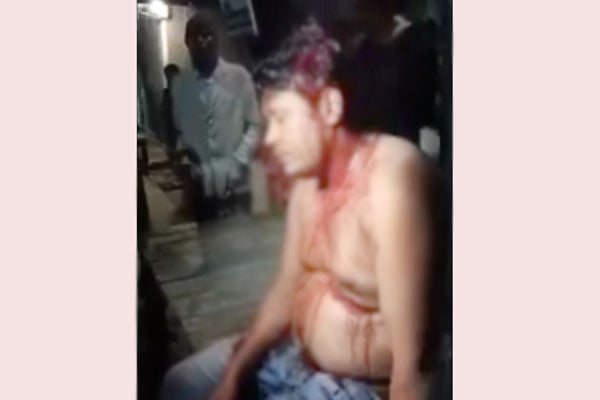 মোংলায় চাঁদা দাবিতে জাহাজে খাদ্য সরবরাহকারীকে কুপিয়ে জখম