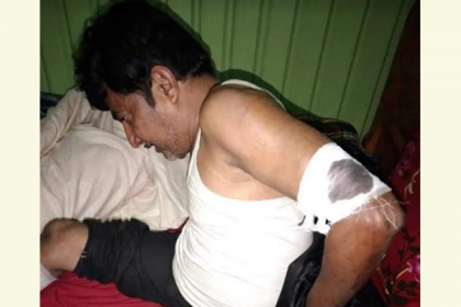 নোয়াখালীতে যুবলীগের নেতাকে কুপিয়ে জখম