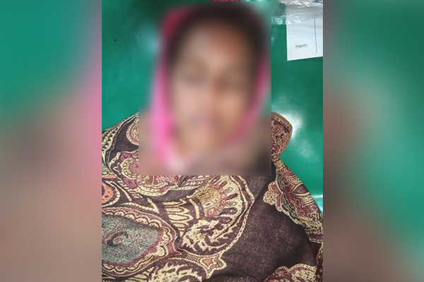 চরফ্যাশনে এসিড নিক্ষেপের ঘটনায় মামলা