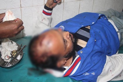 দেবিদ্বারে বিএনপির প্রার্থী ও সমর্থকদের ওপর হামলা, আহত ১২