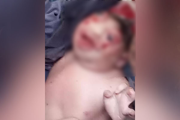 নাসিরনগরে অদ্ভুত আকৃতির শিশুর জন্ম, দেখতে লোকজনের ভিড়