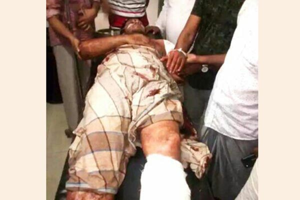 টেকনাফে জমি নিয়ে বিরোধে গুলিবিদ্ধ ১