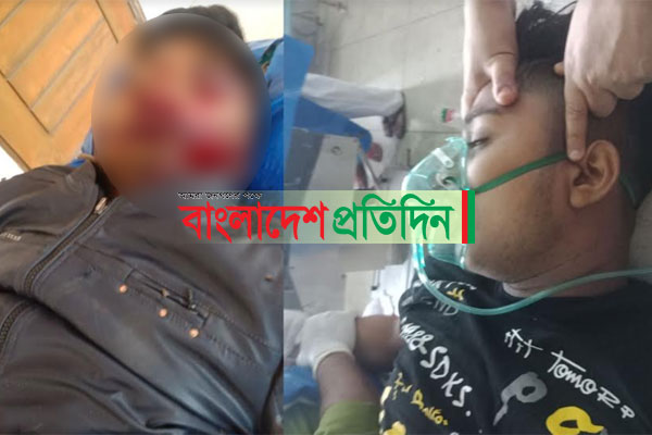 বরিশালের ট্রাক-মোটরসাইকেল মুখোমুখি সংঘর্ষে নিহত ২