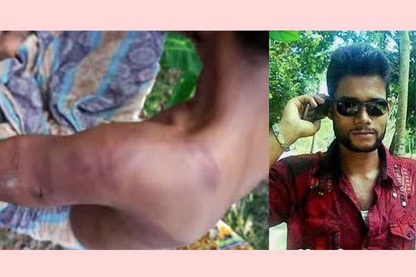 ছাত্রলীগ নেতাকে বেঁধে বিবস্ত্র করে পেটালেন ইউপি মেম্বার!