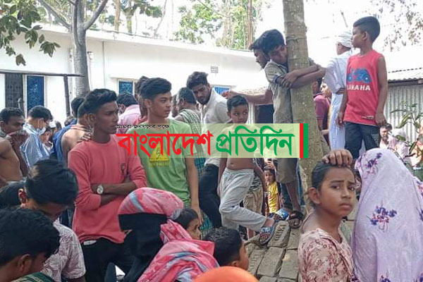 শিবচরে আগুনে পুড়ে শিশুর মৃত্যু