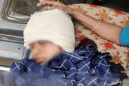 ঘরে ঢুকে কিশোরীকে কুপিয়ে জখম

