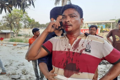 বন্দুকের বাট দিয়ে মেরে ব্যবসায়ীর ৫টি দাঁত ভেঙ্গে দিল পুলিশ