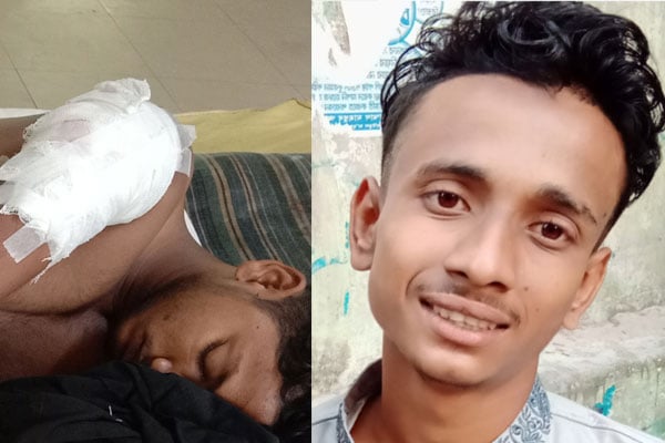মাঠা খেতে দুই কিশোরের মোটরসাইকেল যাত্রা, পথে দুর্ঘটনায় একজন নিহত

