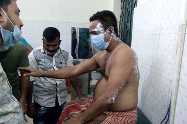 মুন্সীগঞ্জের মিরকাদিমে গ্যাস লাইনের লিকেজ থেকেই বিস্ফোরণ 