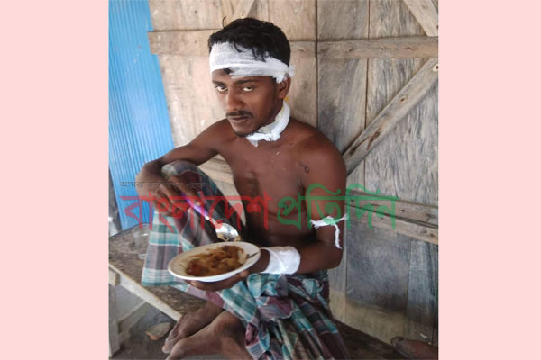 সুন্দরবনে মধু সংগ্রহ করতে গিয়ে বাঘের আক্রমণে মৌয়াল আহত