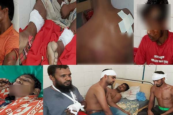বাউফলে দুই মেম্বর প্রার্থীর সমর্থকদের সংঘর্ষ, আহত ২৩