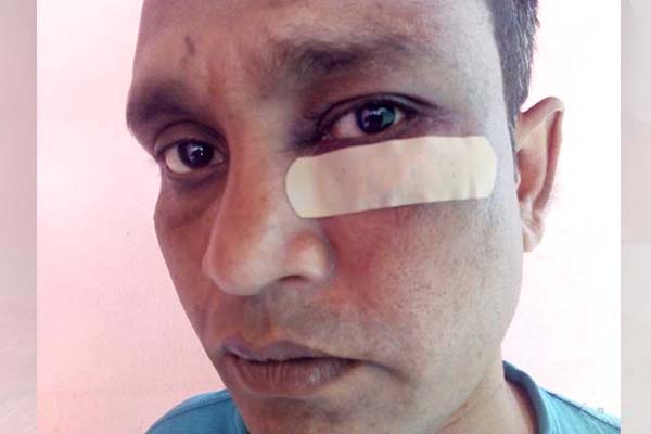 ধুনটে যুবলীগ ও ছাত্রলীগ নেতাকে মারধরের অভিযোগ