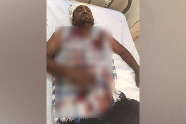 ঠাকুরগাঁওয়ে পৌর ছাত্রদলের আহ্বায়ককে মারধর, হাসপাতালে ভর্তি