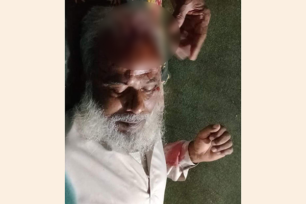 রূপগঞ্জে আওয়ামী লীগ নেতাকে কুপিয়ে জখম