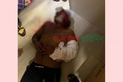 মালয়েশিয়ায় পুলিশ পরিচয়ে বাংলাদেশি কক্ষে ডাকাতি, আহত ৫