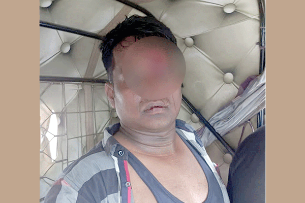 বিশ্বনাথে হামলায় ফল ব্যবসায়ী আহত