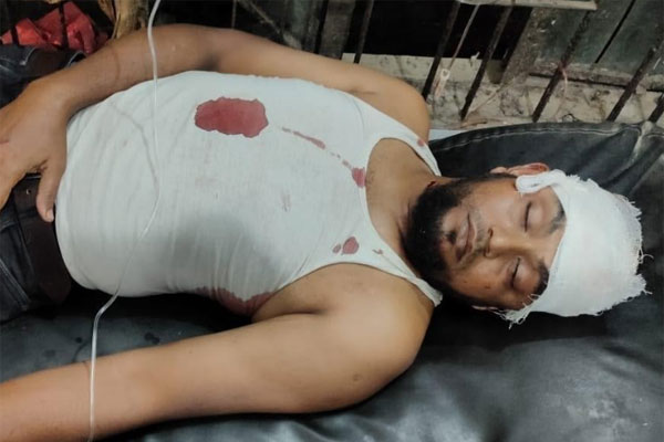 দুর্বৃত্তদের হামলায় সাংবাদিক গুরুতর আহত, অবস্থা সংকটাপন্ন