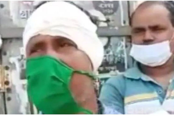 তৃণমূল নেতার ‘কানের মাংস কামড়ে তুলে নিল’ বিজেপির কর্মী

