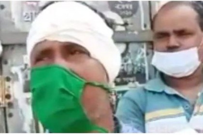 তৃণমূল নেতার ‘কানের মাংস কামড়ে তুলে নিল’ বিজেপির কর্মী

