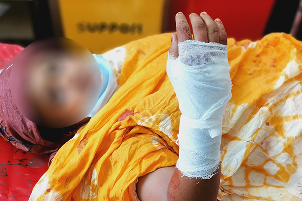 চকরিয়ায় স্লুইসগেট দখলে নিতে হামলা, নারীসহ আহত ৪
