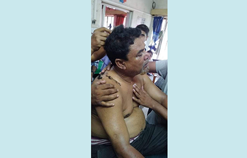 কোটচাঁদপুরে হাতুড়ি পেটায় ইউপি চেয়ারম্যানসহ আহত ৩, আটক ২