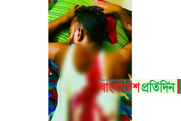 কোম্পানীগঞ্জে গুলিবিদ্ধ দুইজনকে ঢাকায় স্থানান্তর 

