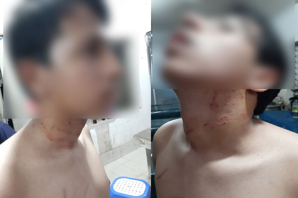 স্ত্রীর সঙ্গে বিরোধে ছেলেকে হত্যাচেষ্টার অভিযোগ ডাক্তার বাবার বিরুদ্ধে

