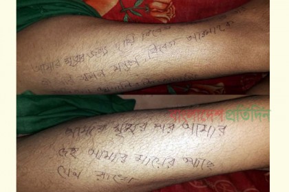 দুই পায়ে মৃত্যুর কারণ ও দায়ীদের নাম লিখে গেলেন গৃহবধূ