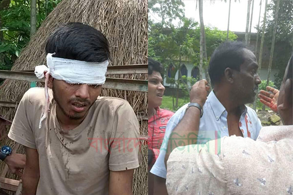 ফের রণক্ষেত্র কোম্পানীগঞ্জ, বাদল অনুসারী ৪ জন গুলিবিদ্ধ