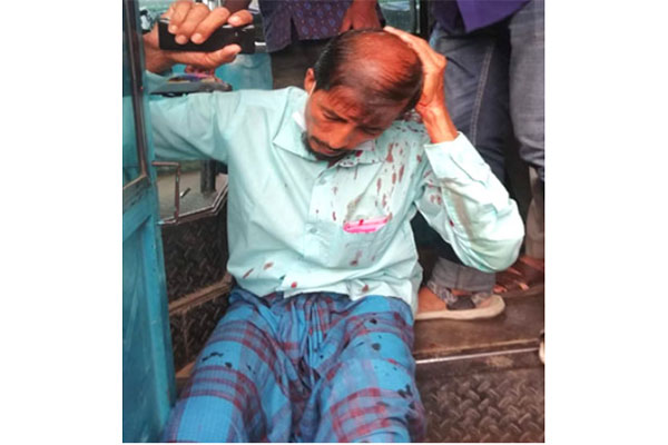 বাড়তি ভাড়া দিতে না চাওয়ায় যাত্রীর মাথা ফাটালেন হেলপার

