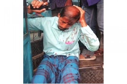 বাড়তি ভাড়া দিতে না চাওয়ায় যাত্রীর মাথা ফাটালেন হেলপার

