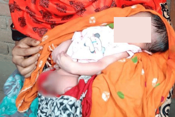 চাঁপাইনবাবগঞ্জে পা ছাড়া শিশুর জন্ম, দুশ্চিন্তায় দরিদ্র পরিবার 
