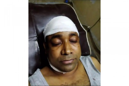 রূপগঞ্জে সাংবাদিকের উপর হামলা