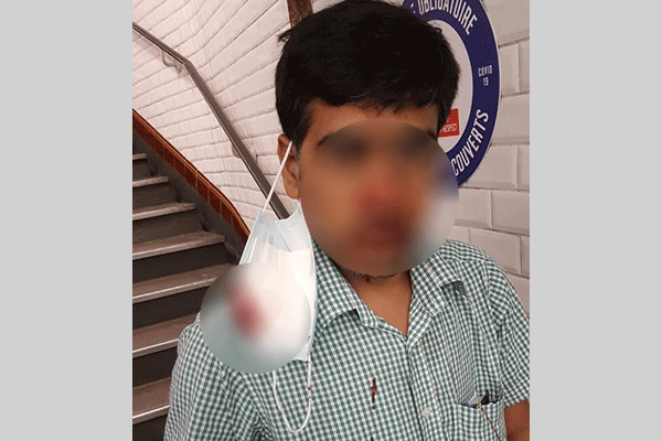 প্যারিসে কাজ থেকে ফেরার পথে বাংলাদেশির ওপর হামলা