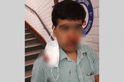 প্যারিসে কাজ থেকে ফেরার পথে বাংলাদেশির ওপর হামলা