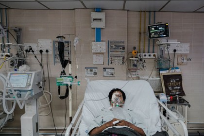 ভারতে বাড়ছে ব্ল্যাক ফাঙ্গাসের সংক্রমণ, স্বাভাবিক জীবন হারাচ্ছেন আক্রান্তরা