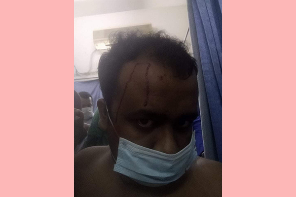 মগবাজারের বিস্ফোরণে শেকৃবি ছাত্রলীগ নেতা আহত