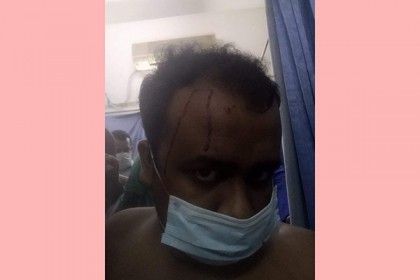 মগবাজারের বিস্ফোরণে শেকৃবি ছাত্রলীগ নেতা আহত