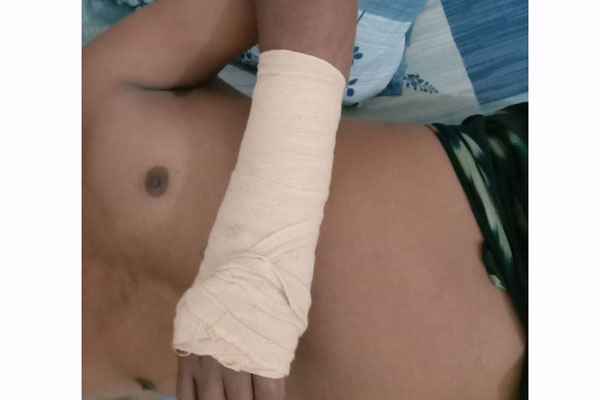 লকডাউনে বাগমারায় কলেজশিক্ষককে পেটানোর অভিযোগ
