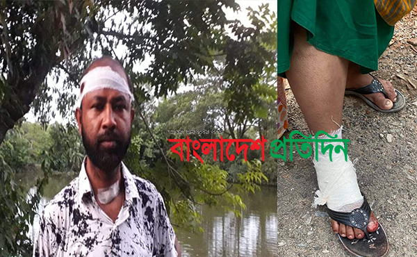 কোম্পানীগঞ্জে ভাইস চেয়ারম্যানের বাড়িতে ককটেল নিক্ষেপ ও গুলি করার অভিযোগ, গুলিবিদ্ধ ৩