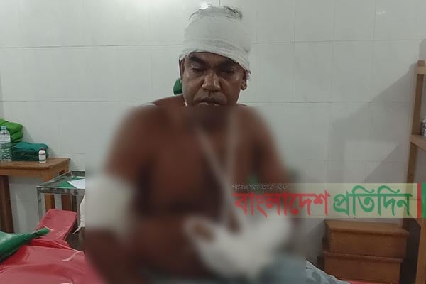পশুর হাট থেকে ফেরার পথে প্রবাসীকে কুপিয়ে জখম
