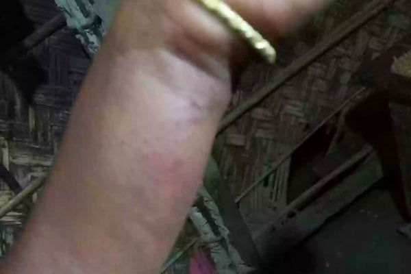 সুবর্ণচরে যৌতুকের দাবিতে গৃহবধূকে নির্যাতনের অভিযোগ
