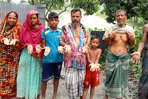 শাজাহানপুরে বেড়েছে আর্সেনিকের ঝুঁকি 