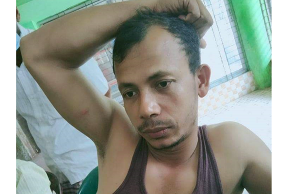 খাবারের খোঁজে লোকালয়ে বন্যহাতির দল, আক্রমণে যুবক আহত